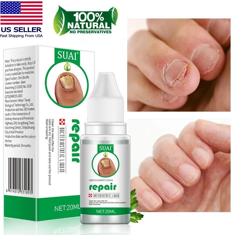 Nail Fungal Treatment Gel Foot Toenail Fingernail Renewal Repair Fungus Removal