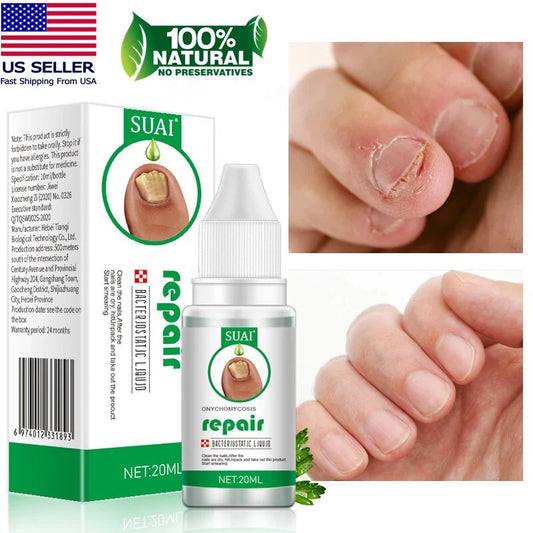 Nail Fungal Treatment Gel Foot Toenail Fingernail Renewal Repair Fungus Removal