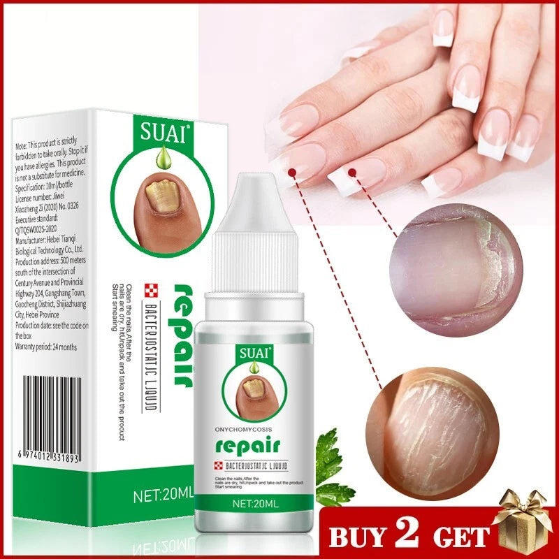 Nail Fungal Treatment Gel Foot Toenail Fingernail Renewal Repair Fungus Removal
