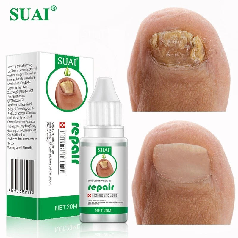 Nail Fungal Treatment Gel Foot Toenail Fingernail Renewal Repair Fungus Removal